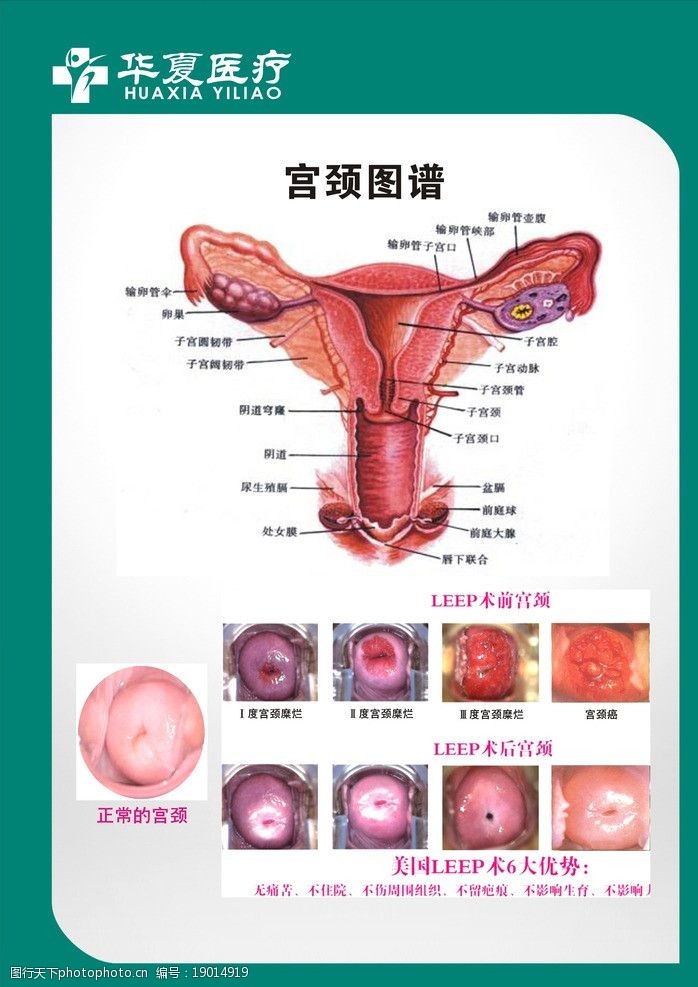 生殖系统图妇科图谱妇科生殖图片