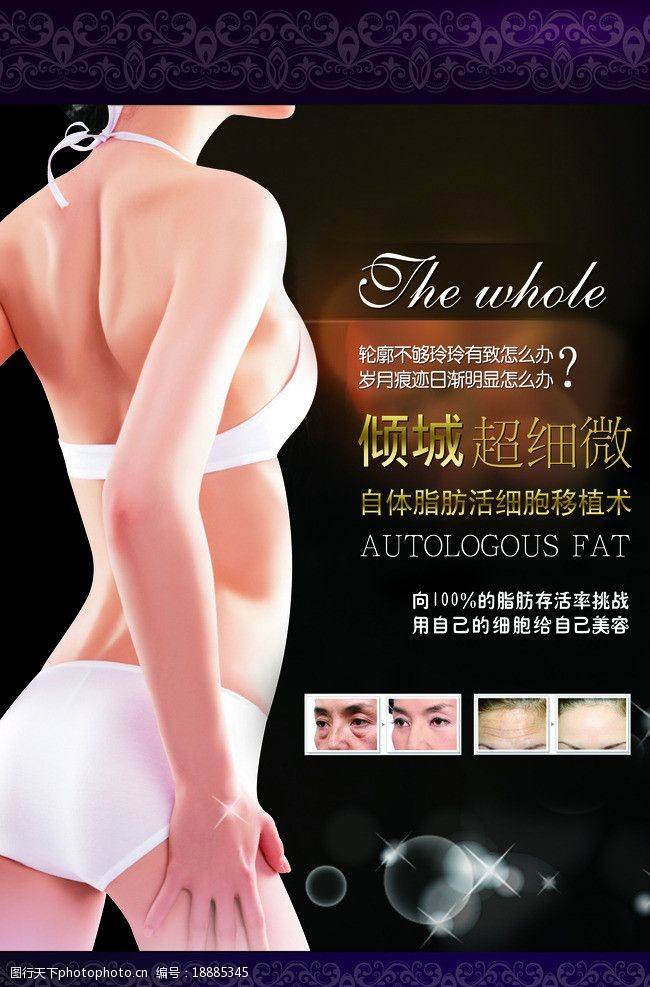 美容术自体脂肪移植术海报图片